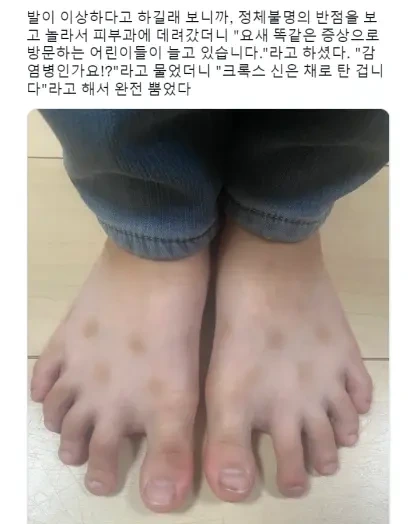 다들 여름 피부병 조심해.jpg | 인스티즈