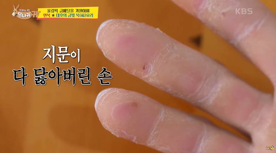 현재 메달 가능성 높다는 비인기 종목들 | 인스티즈