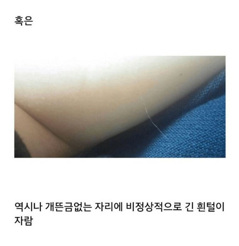 쌩뚱맞은 부위에 자라는 털.jpg | 인스티즈