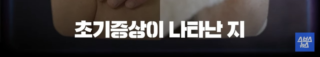 하루만에 사망 가능한 20대 감염자 1위 질병 | 인스티즈