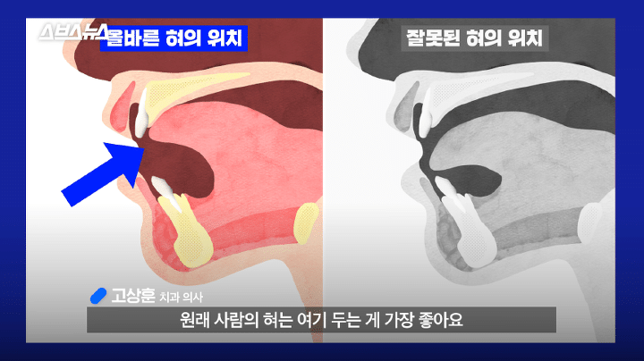 은근 중요한 혀 두는 위치.jpg | 인스티즈