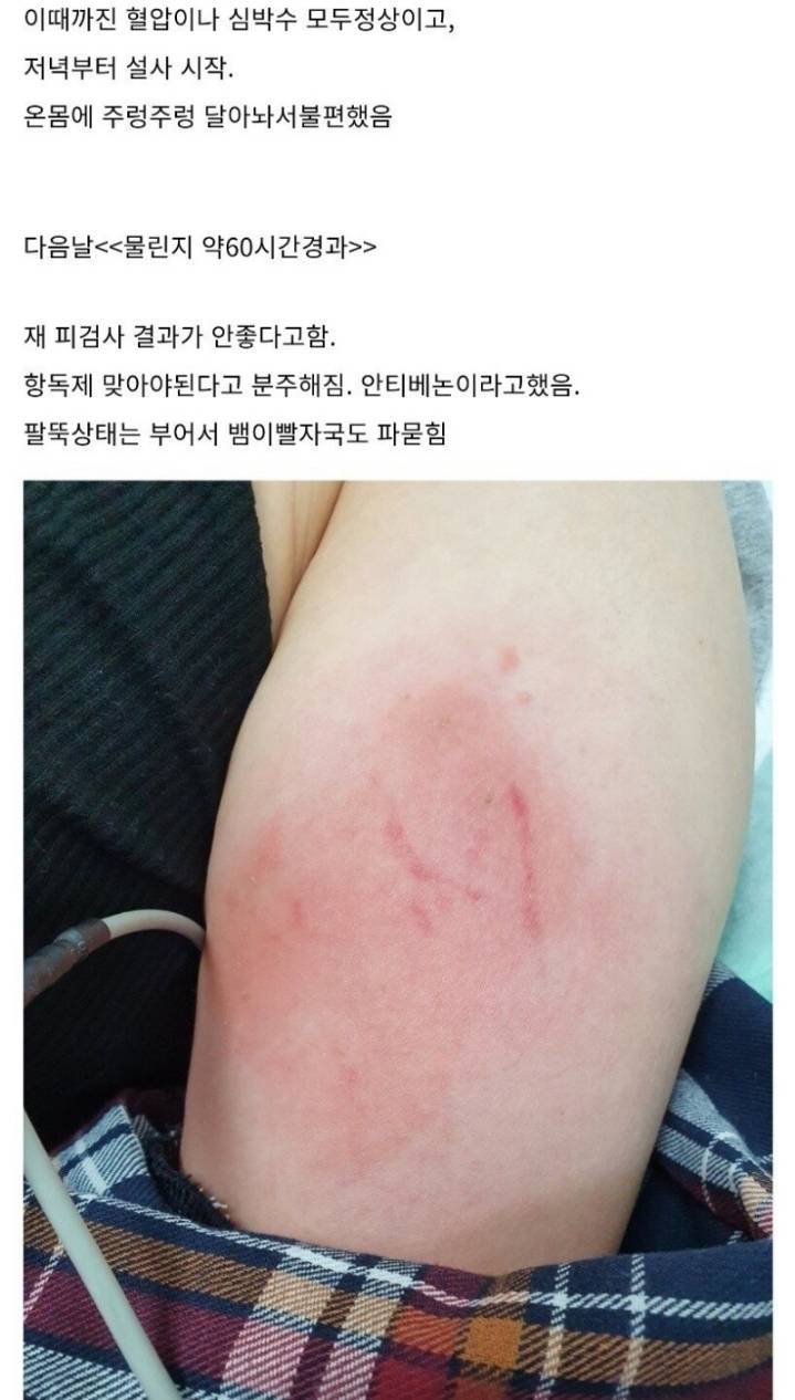 산책하다가 독사에게 물린 디시인 후기.jpg | 인스티즈