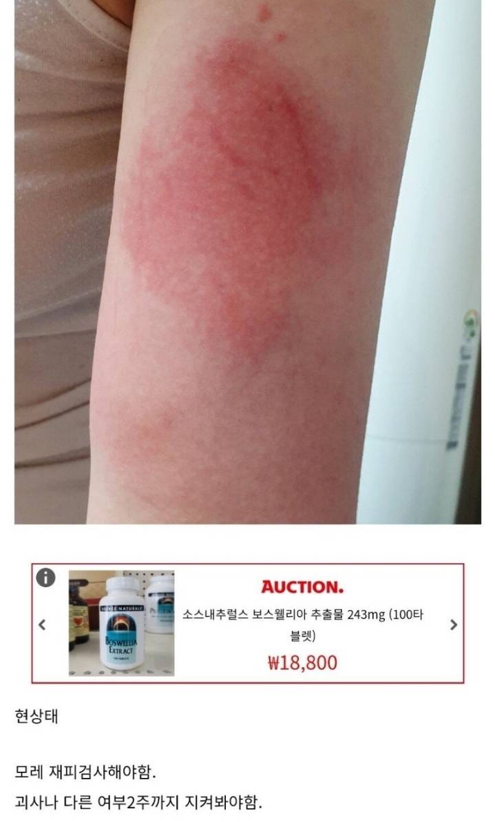 산책하다가 독사에게 물린 디시인 후기.jpg | 인스티즈