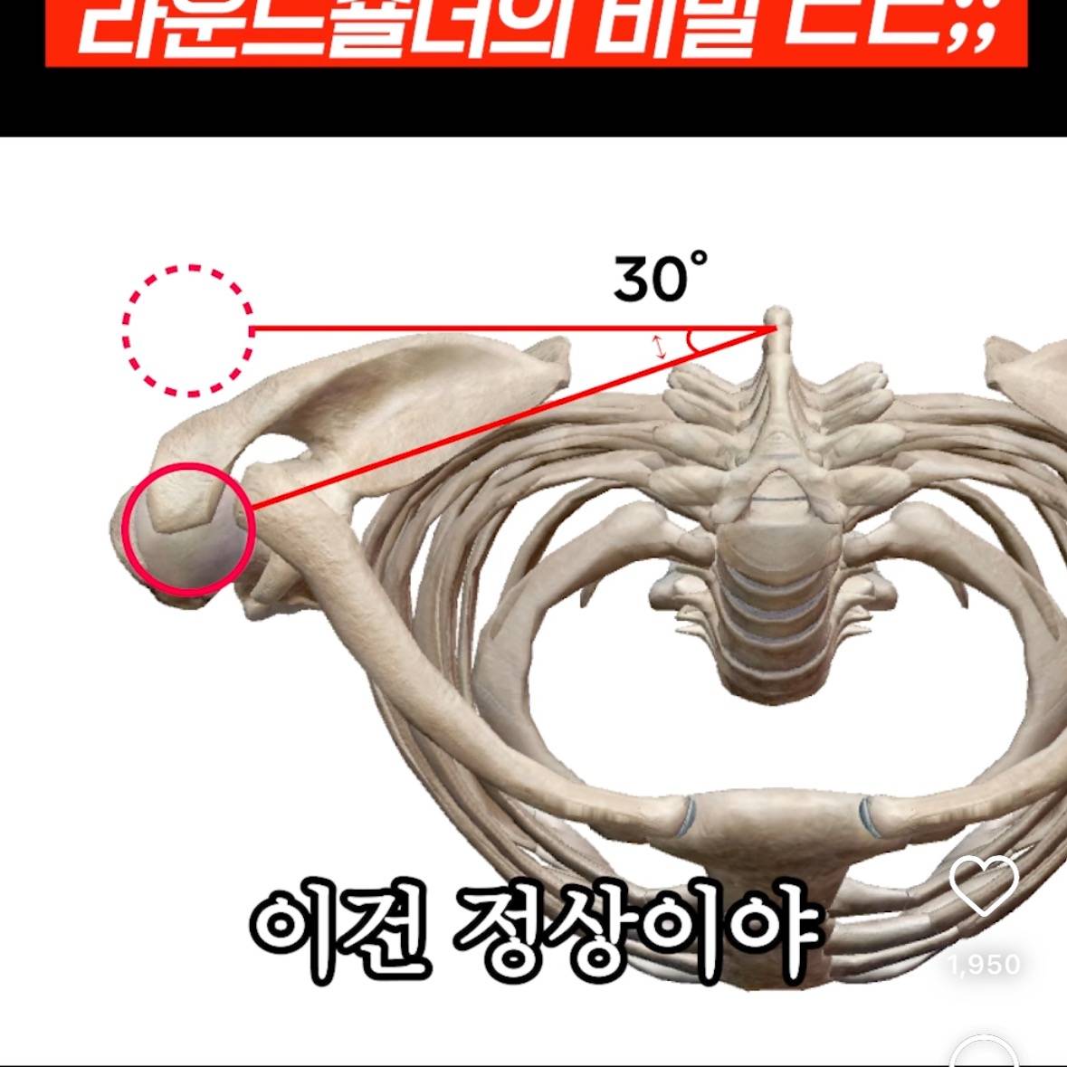 절반은 잘못알고 있다는 라운드숄더의 진실 | 인스티즈