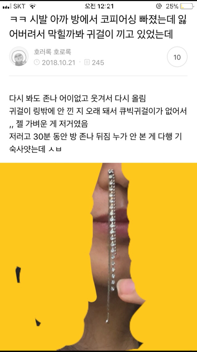 나 죽고싶어 보톡하는줄도 모르고 오줌쌌어... | 인스티즈