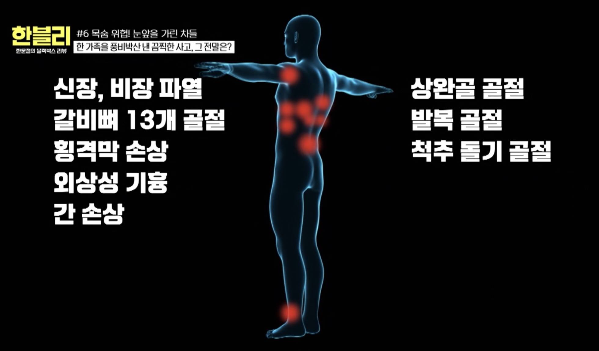 [한블리] 4톤 지게차에 30대 여자 직원이 깔린 충격적인 사건 | 인스티즈