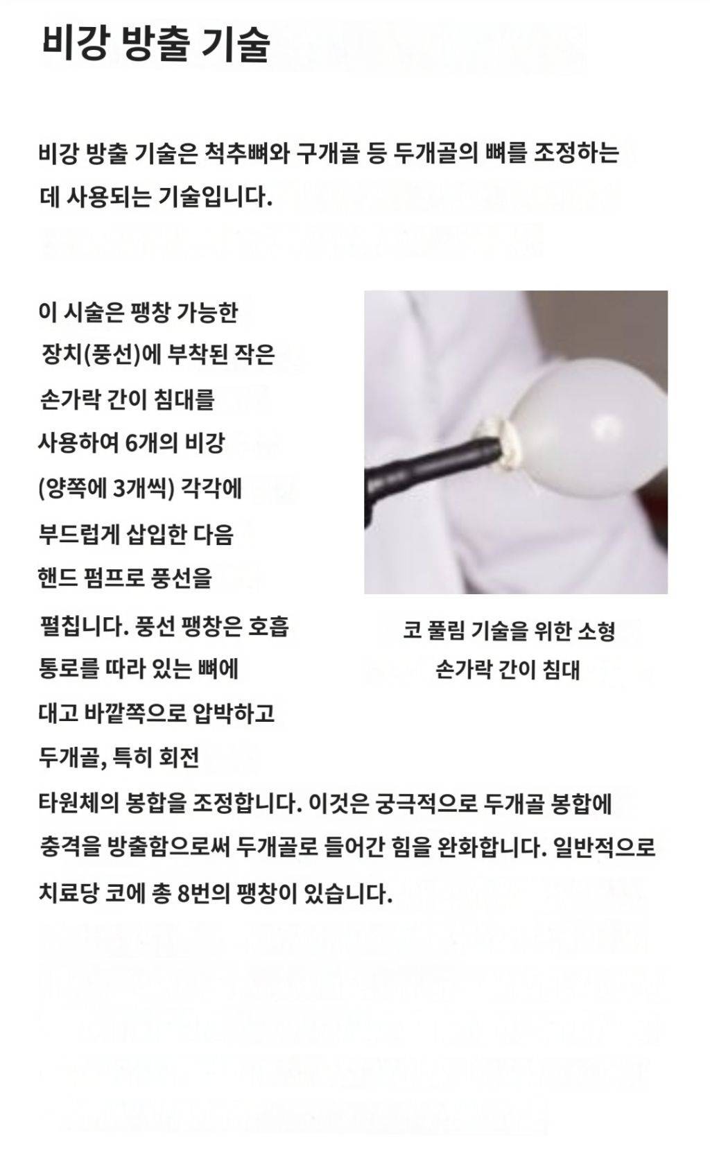 코에 풍선 넣어 치료하는 시술 개시원해보임 | 인스티즈