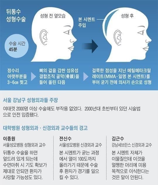 의외로 하는 사람 꽤 있다는 성형수술 부위.jpg | 인스티즈