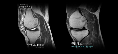 러닝만큼 가성비 넘치고 정신건강에 좋은운동 없다고 생각하는 달글 | 인스티즈