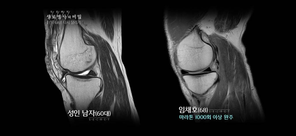 달리기 런닝 이거 완전 만병통치약임 | 인스티즈