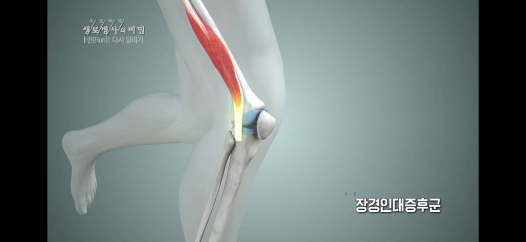 달리기 런닝 이거 완전 만병통치약임 | 인스티즈