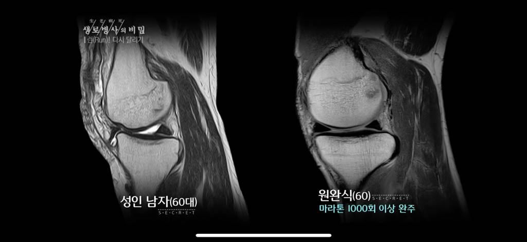 달리기 런닝 이거 완전 만병통치약임 | 인스티즈