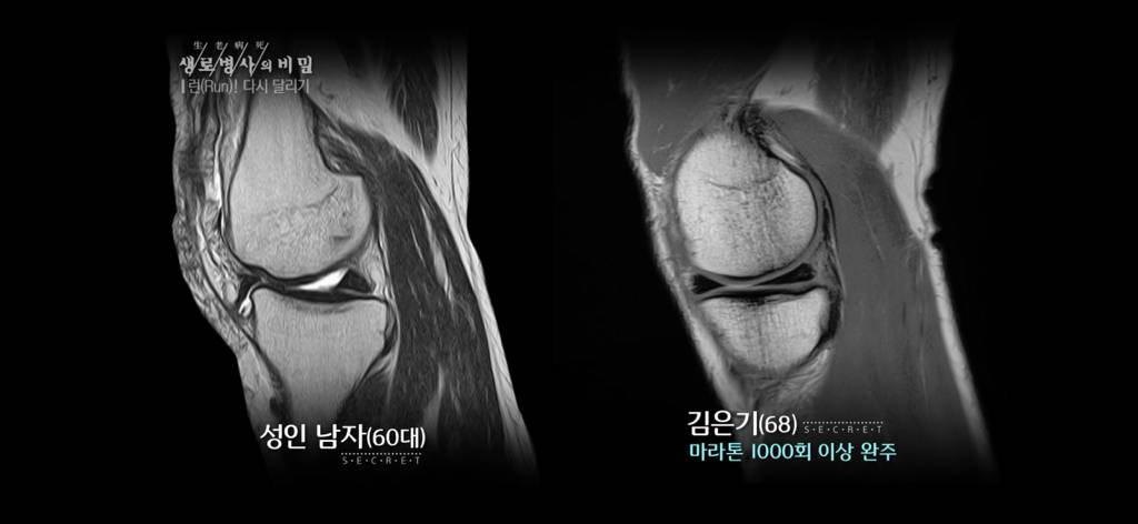 달리기 런닝 이거 완전 만병통치약임 | 인스티즈