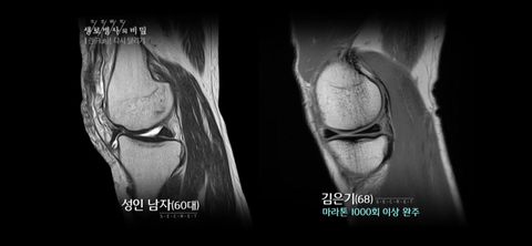 러닝만큼 가성비 넘치고 정신건강에 좋은운동 없다고 생각하는 달글 | 인스티즈