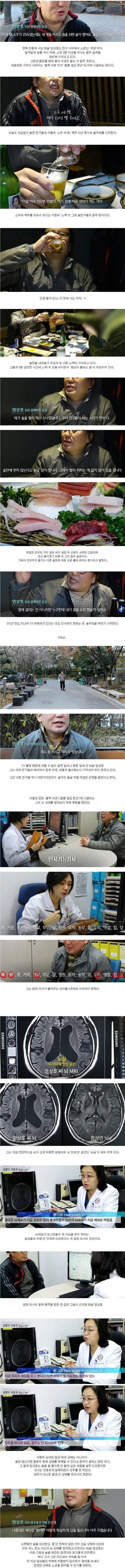 50대 애주가의 뇌상태 | 인스티즈