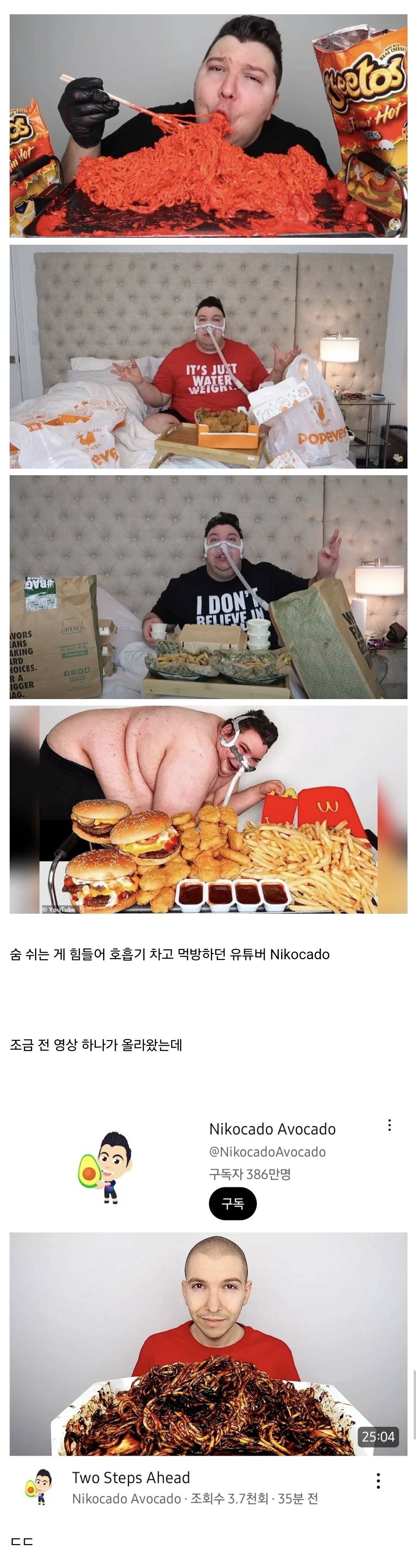 먹방하다 90kg 쪄 산소호흡기 차던 유튜버 니코카도 진짜 실시간 충격 근황.jpg | 인스티즈