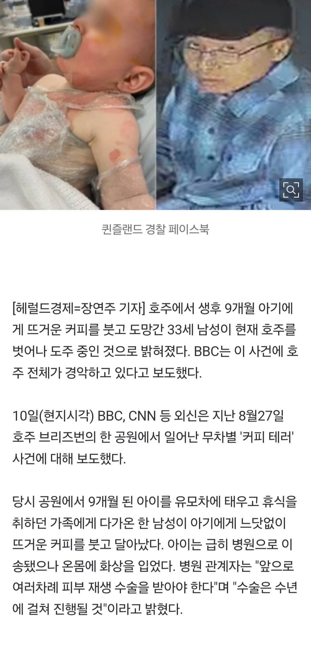 9개월 아기에 '뜨거운 커피' 붓고 도망친 33세男…호주서 '해외도피', 국제 수배령 | 인스티즈