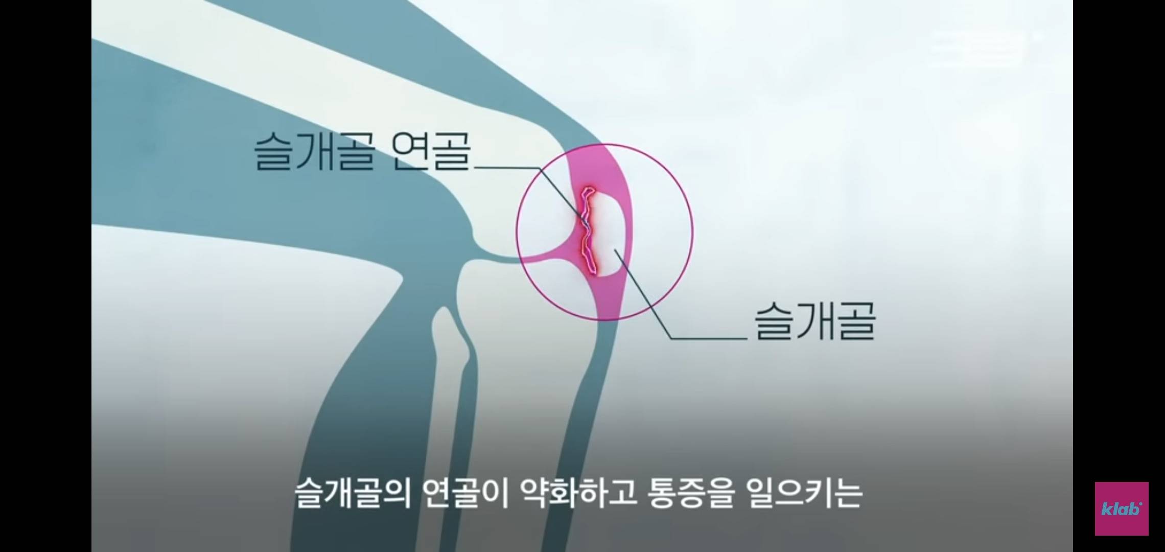 의자 위에서 양반다리가 편한 사람은 허리가 약한 것.jpg | 인스티즈