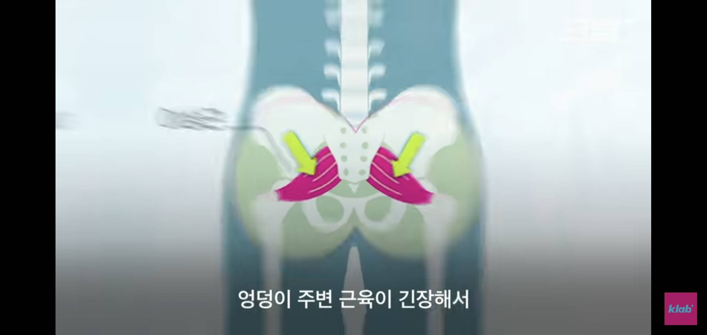 의자 위에서 양반다리가 편한 사람은 허리가 약한 것.jpg | 인스티즈