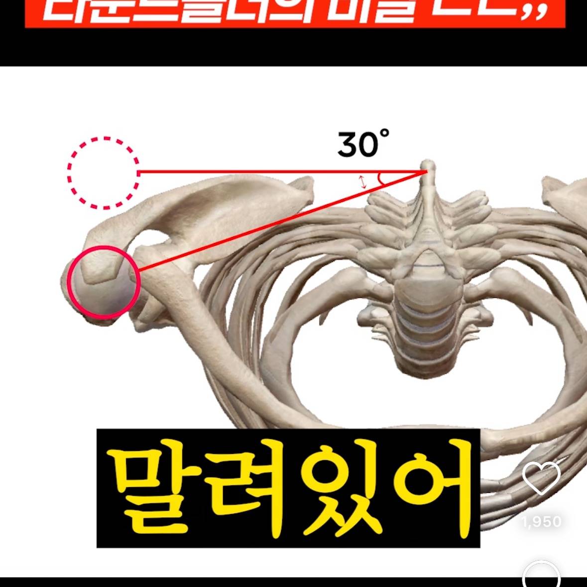 절반은 잘못알고 있다는 라운드숄더의 진실 | 인스티즈