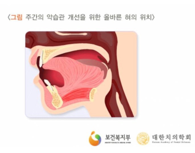 혀의 올바른 위치는 아래쪽vs윗쪽?? .jpg | 인스티즈