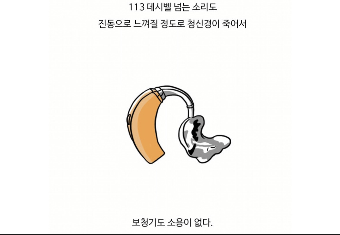 청각장애인들은 꿈에서도 안 들릴까? | 인스티즈
