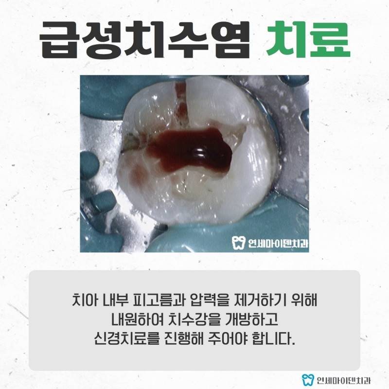 의학계 3대 통증.jpg | 인스티즈