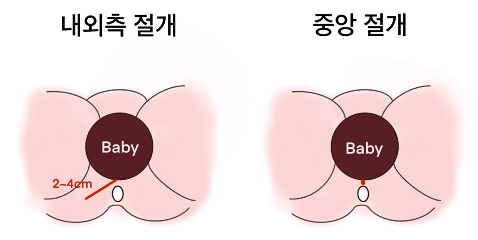 의학계 3대 통증.jpg | 인스티즈