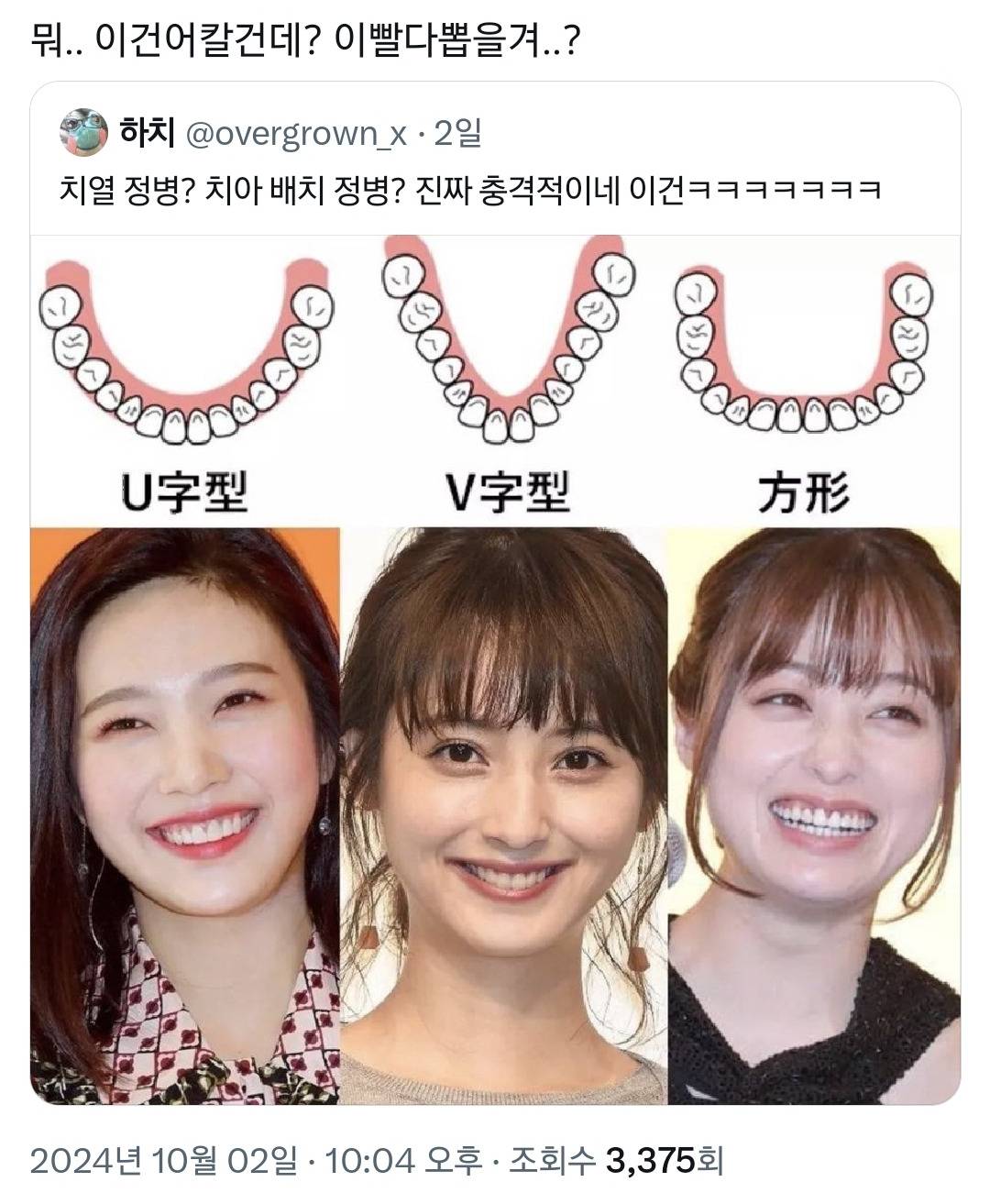 중안부 외모 집착을 능가하는 일녀들의 치아 배열 정병.twt | 인스티즈