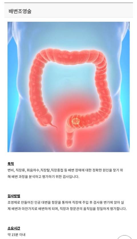 와 나 치질로 병원갔는데 ㄸ싸는 과정을 촬영해야 된대 | 인스티즈