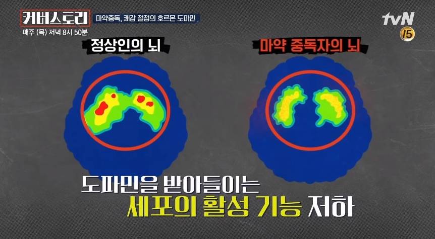 마약을 한번이라도 하면 뇌가 영구 손상됨.jpg | 인스티즈