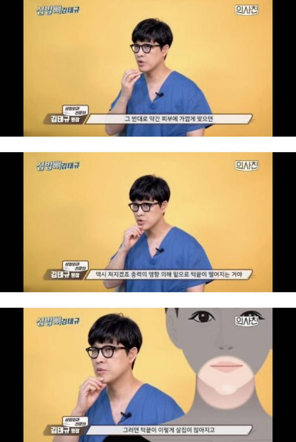 [필러부작용] 의사피셜 필러 절대 맞지 말아야 할 4군데 | 인스티즈