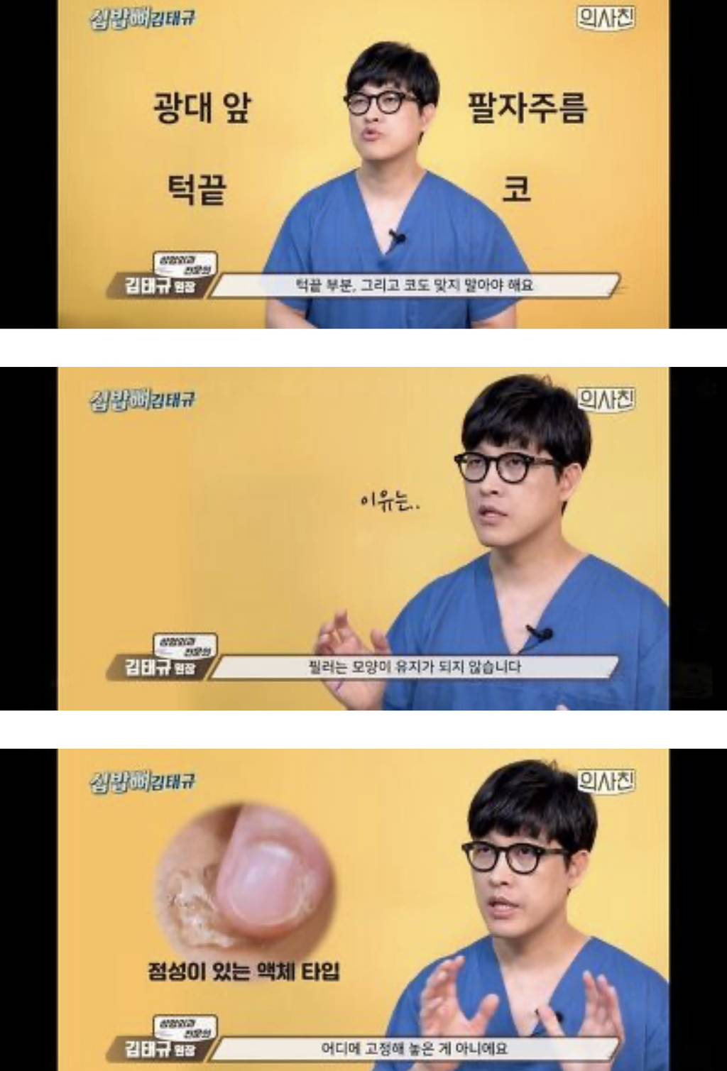 [필러부작용] 의사피셜 필러 절대 맞지 말아야 할 4군데 | 인스티즈