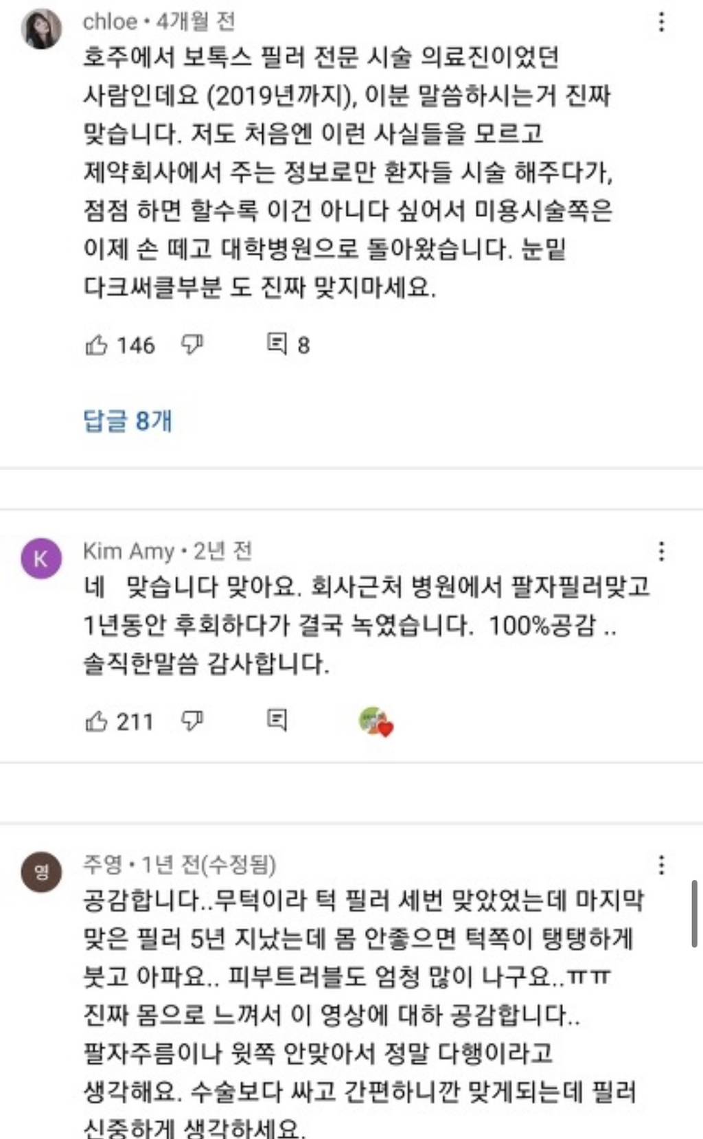 [필러부작용] 의사피셜 필러 절대 맞지 말아야 할 4군데 | 인스티즈