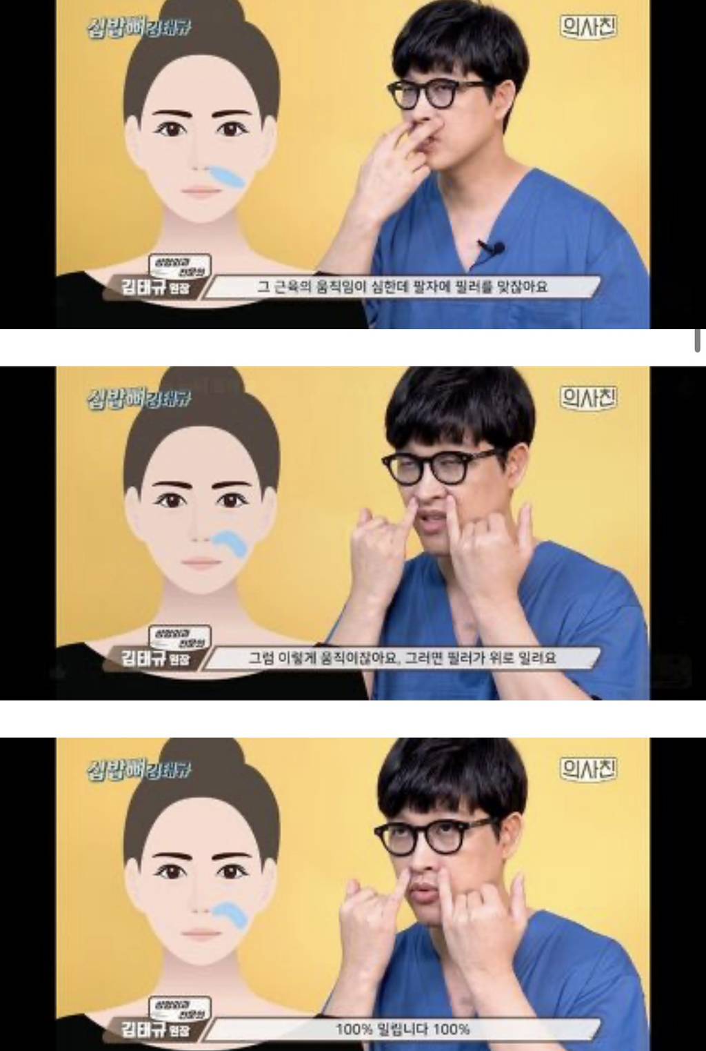 [필러부작용] 의사피셜 필러 절대 맞지 말아야 할 4군데 | 인스티즈
