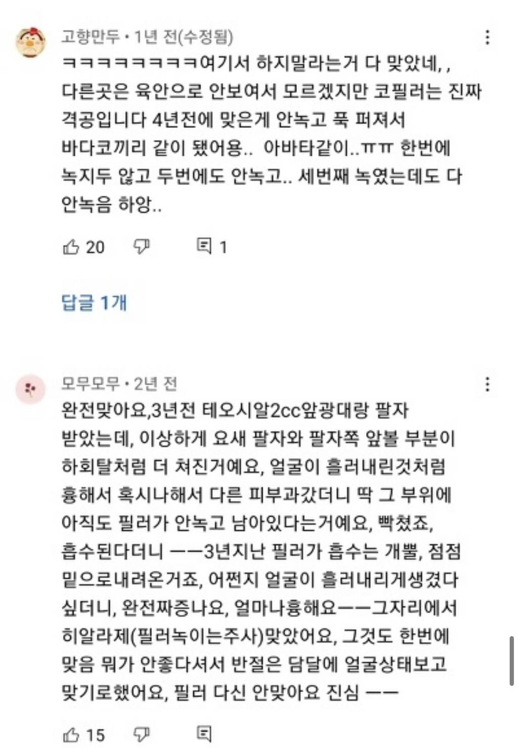 [필러부작용] 의사피셜 필러 절대 맞지 말아야 할 4군데 | 인스티즈