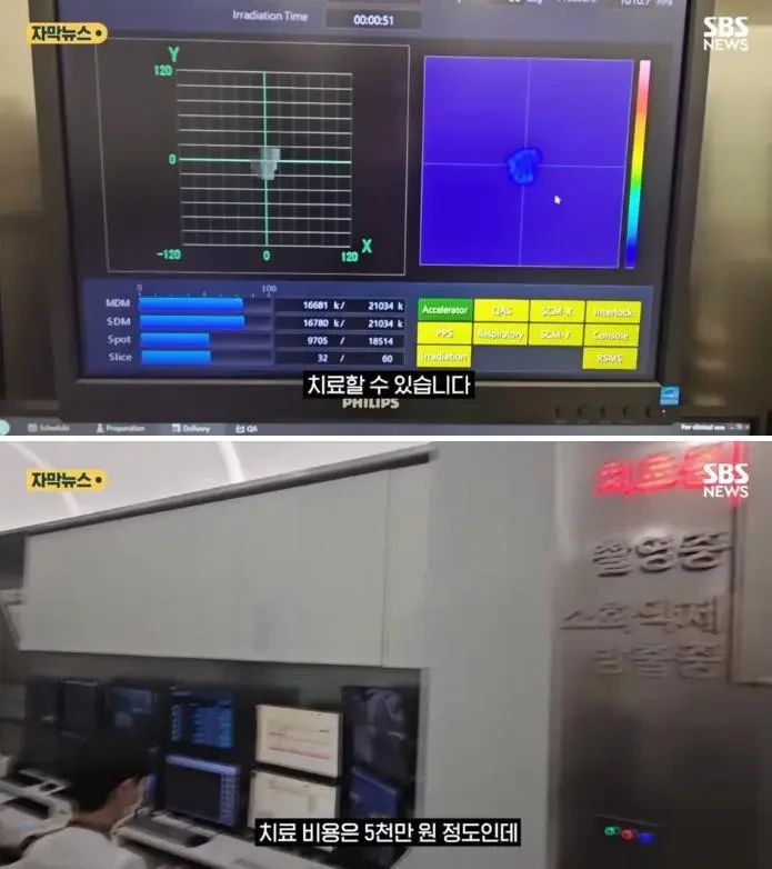 중입자 암치료 기계 근황 | 인스티즈