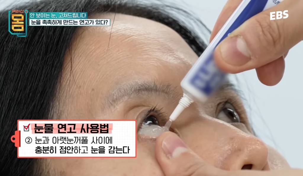 와 안구 건조증 연고 이 정도 넣으랰ㅋㅋㅋㅋㅋㅋㅋㅋ | 인스티즈