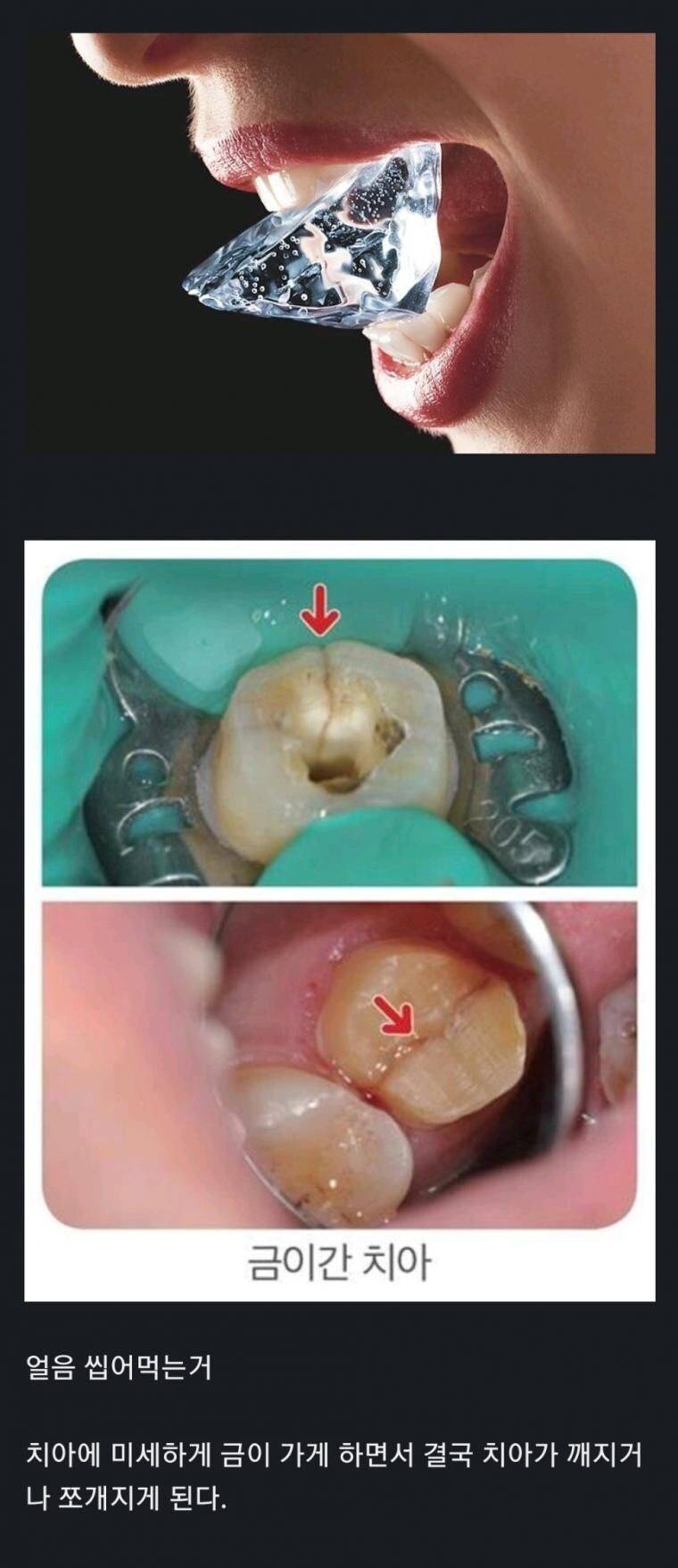 치아 수명 줄이는 최악의 행위.jpg | 인스티즈