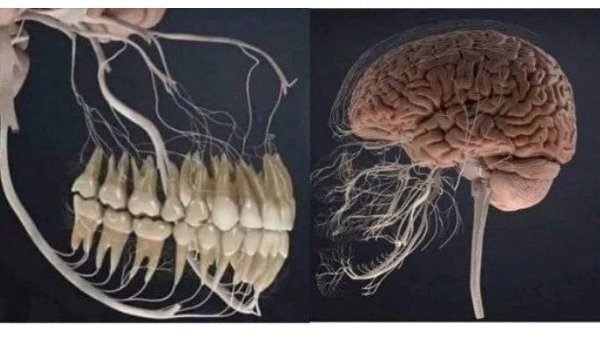 충치치료할때 뜯어내는 신경조직들.jpg | 인스티즈