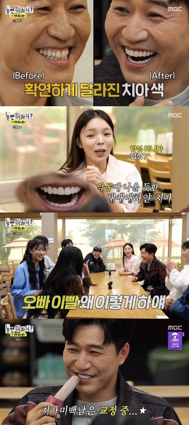 요즘 연예인들이 하는 치아 시술 | 인스티즈