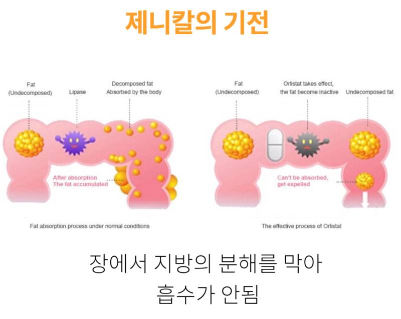 다이어트 약 끝판왕.jpg | 인스티즈