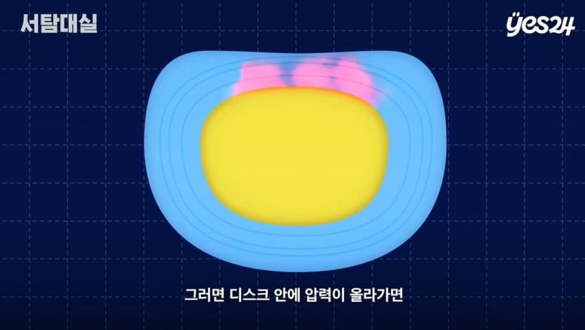 의사가 알려주는 독서를 위한 최적의 자세 | 인스티즈