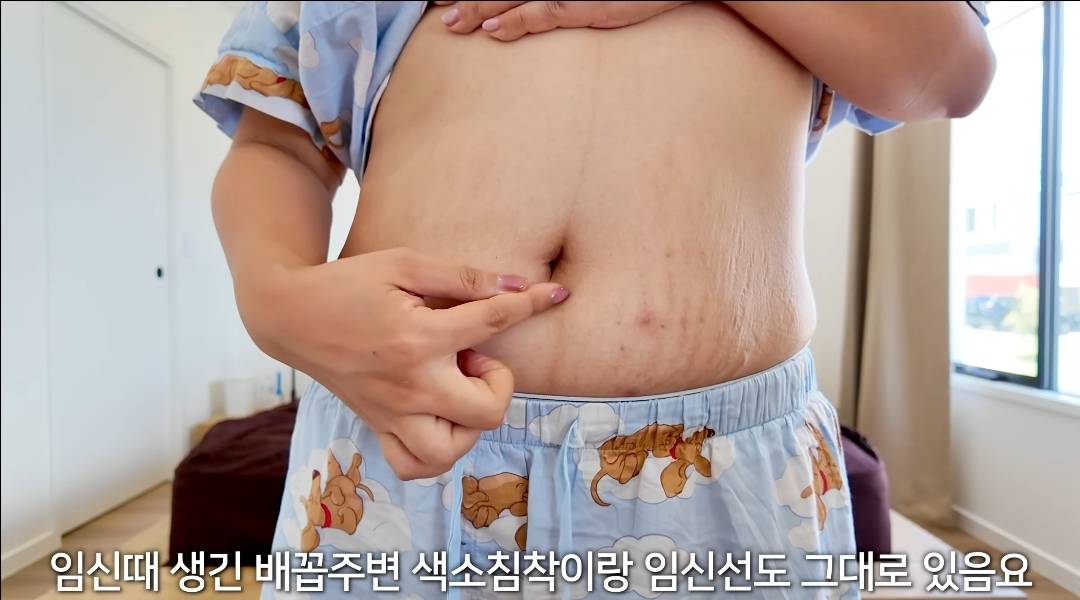 출산 후 10개월 된 해쭈의 몸 변화 | 인스티즈