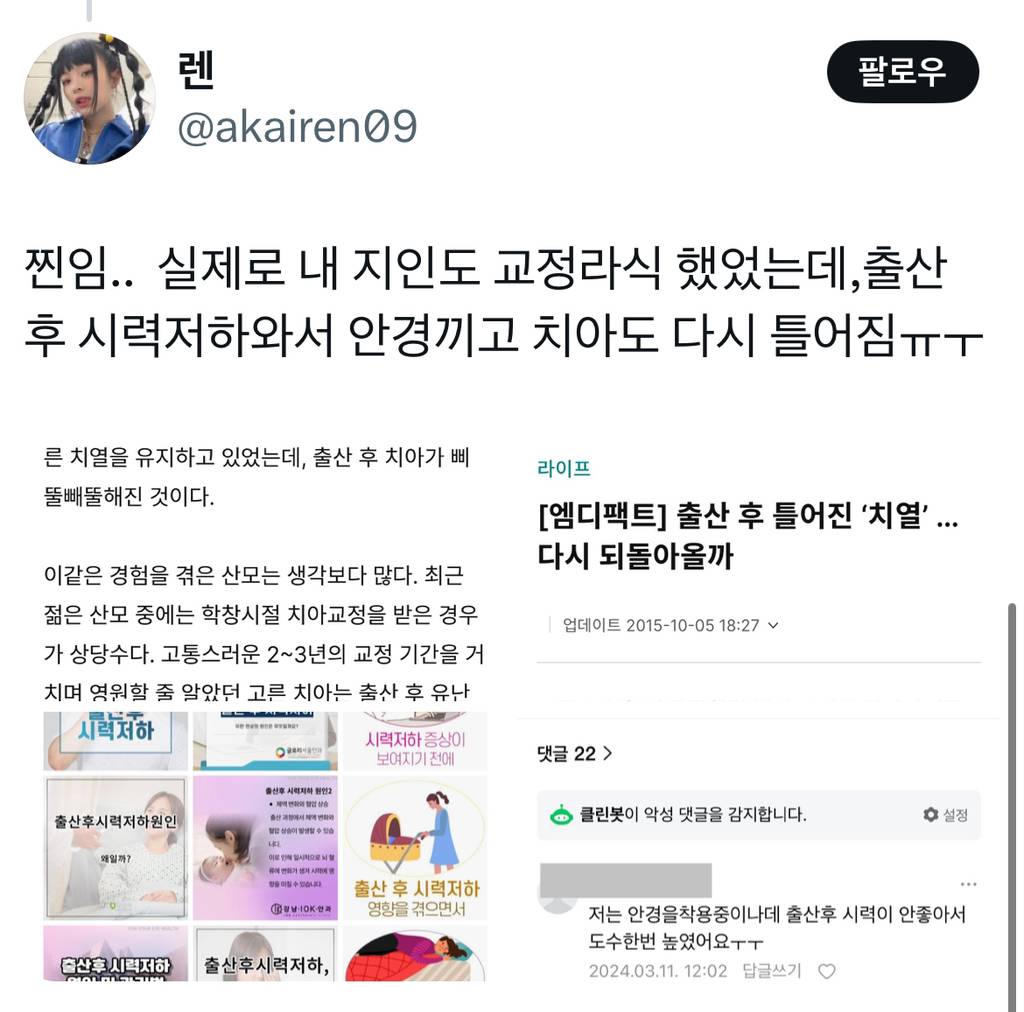 출산하면 치아교정한것도 다시 틀어지고 라식한것도 다시 돌아가서 시력떨어짐... | 인스티즈