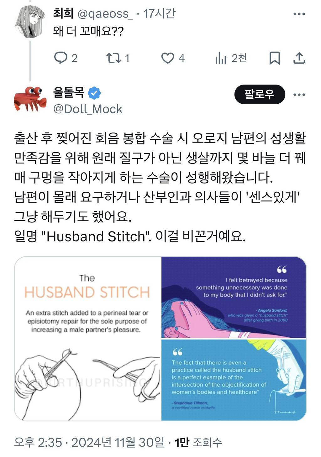 내 남편이 치질수술 들어갔거든? 의사한테 눈 찡긋하고 몰래 한 바늘 더 꼬매달라고 했어^^.x | 인스티즈