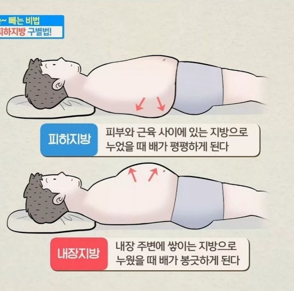 피하지방과 내장지방 차이 | 인스티즈