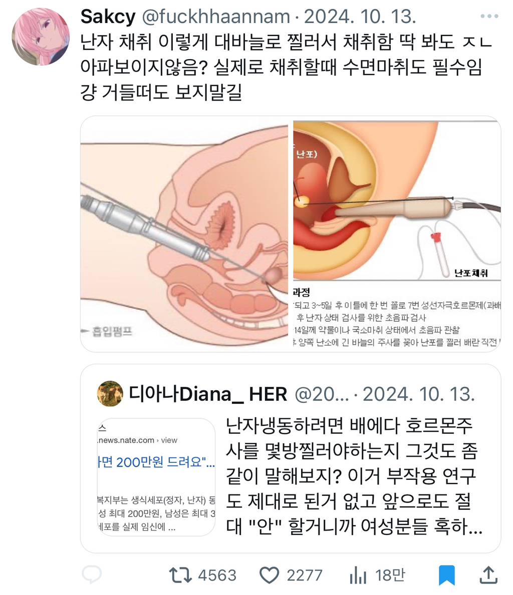 난자 냉동하면 200만원 드려요 | 인스티즈