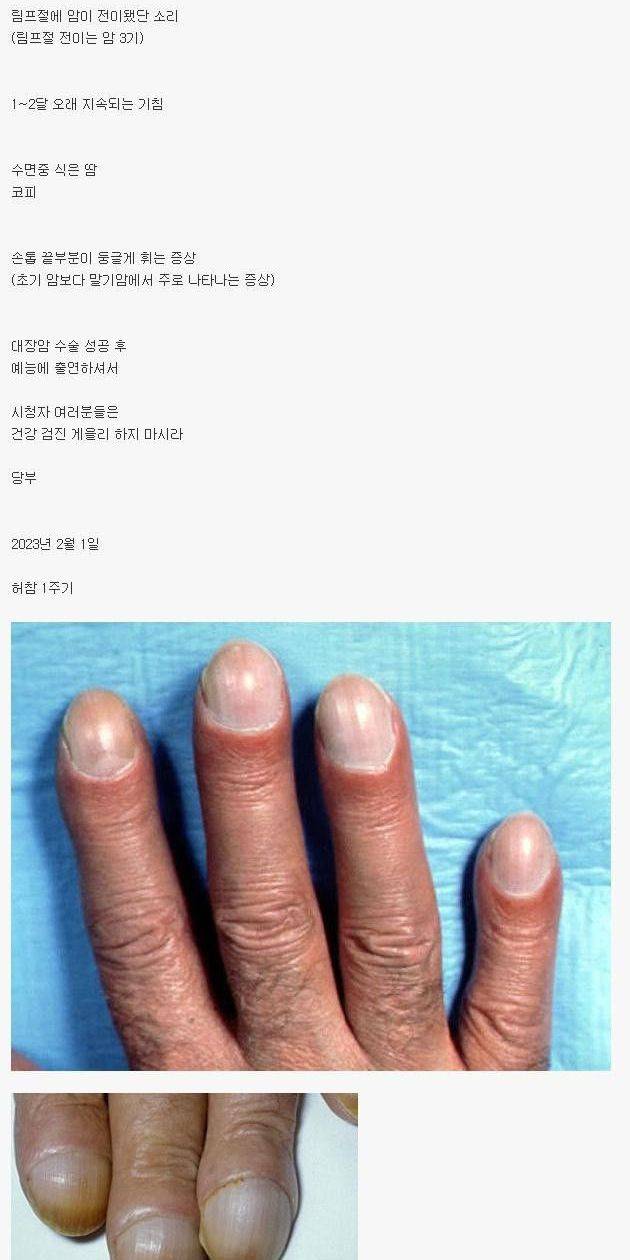 연예인이 느낀 암의 전조증상.jpg | 인스티즈