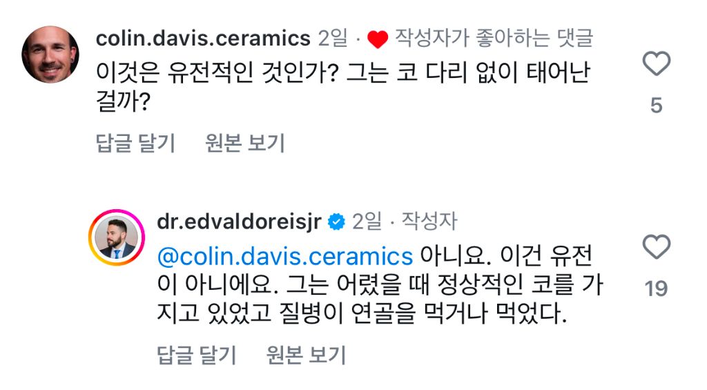 인스타에서 화제된 해외 코성형 전후 | 인스티즈